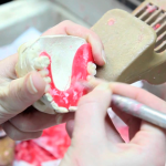 laboratorio-protesis-dental