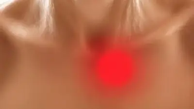 Primer plano de mucocele en el interior de la boca mostrando bulto en mucosa labial para diagnóstico dental.