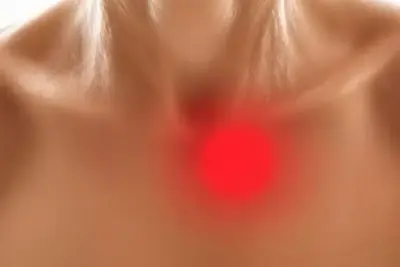 Primer plano de mucocele en el interior de la boca mostrando bulto en mucosa labial para diagnóstico dental.